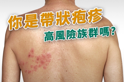 你是帶狀疱疹高危險族群嗎?