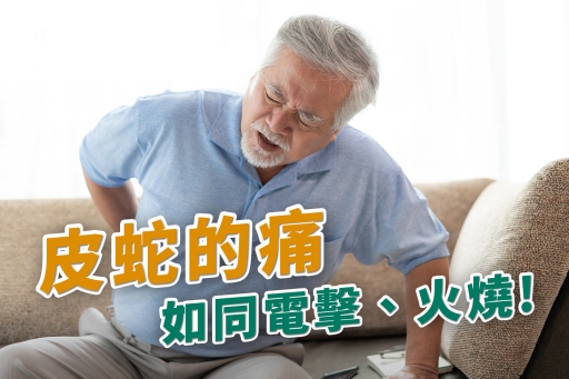 皮蛇疼痛如同電擊、火燒？